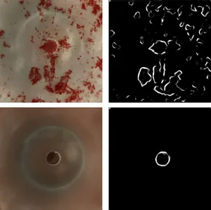 Camera views of agglutination samples on the left with the corresponding edge detection output on the right